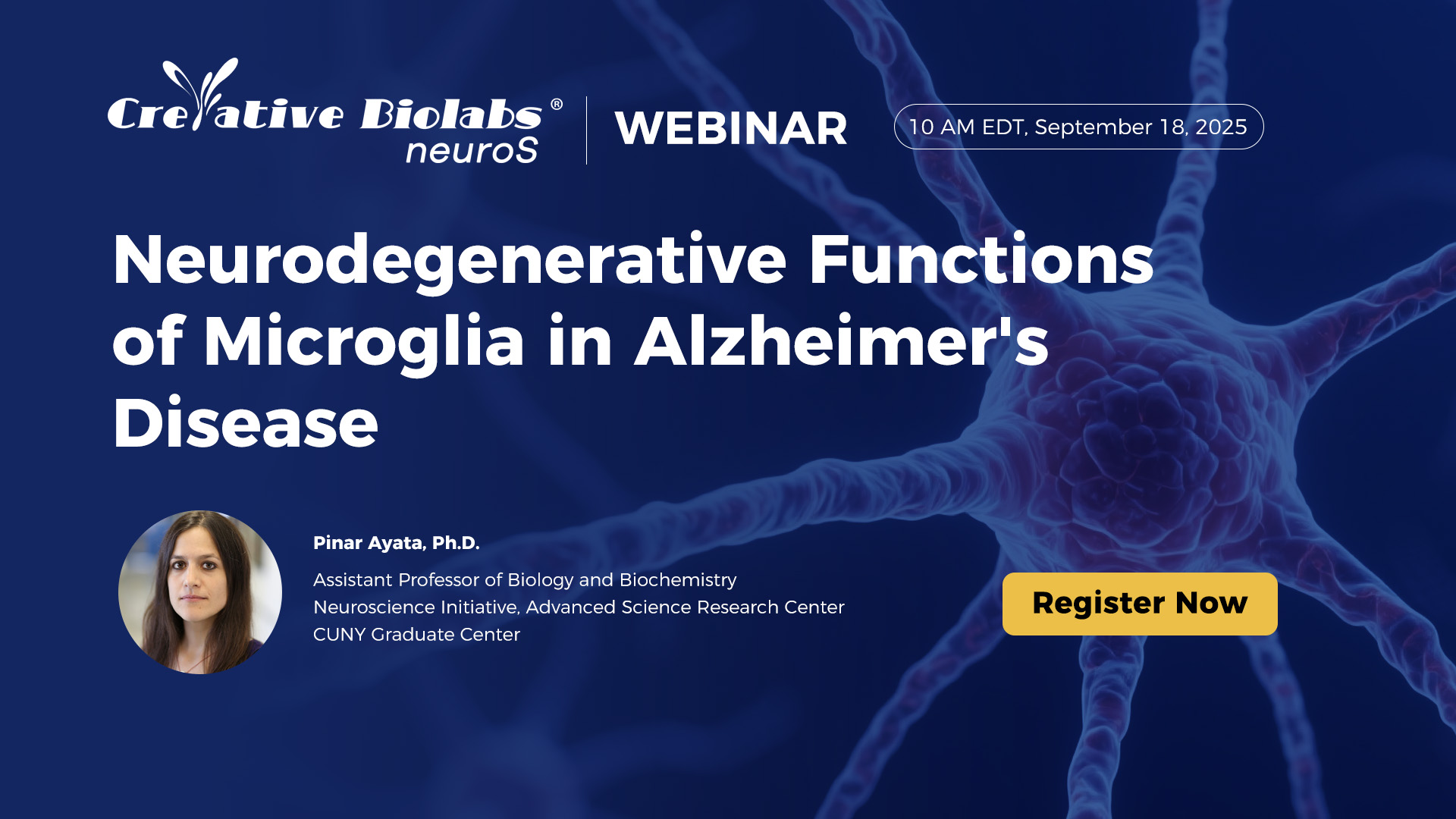 neurodegenerative functions of microglia in AD